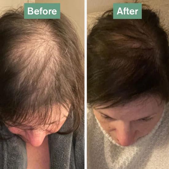 Dr Vegan Hair Saviour Capsules 60 Capsules