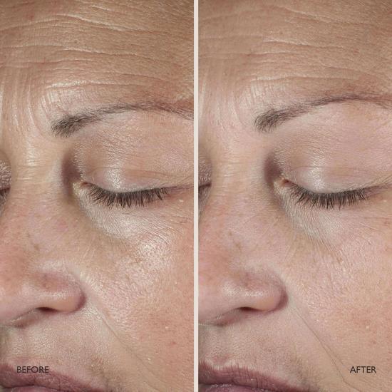 Omorovicza Queen Serum 30ml