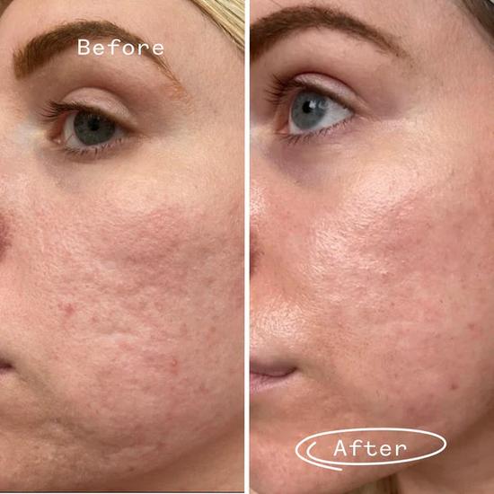 Pai Hyaluronic Acid Booster 0.3%