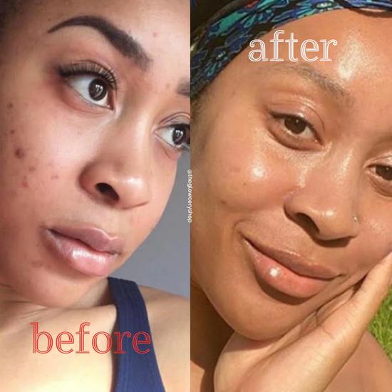 The Glowcery Tomato Tonic Fragrance-Free Superfood Facial Serum