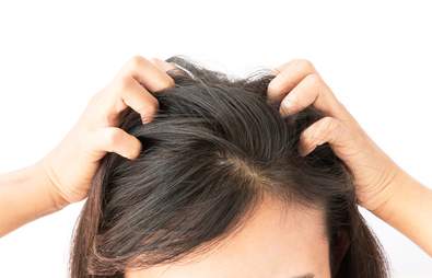 The Best Treatments for Dry Scalps & Itchiness